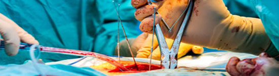 La chirurgie de la colonne vertébrale